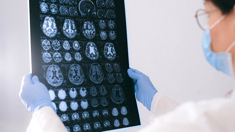 X-ray imaging related to spinal fusion
